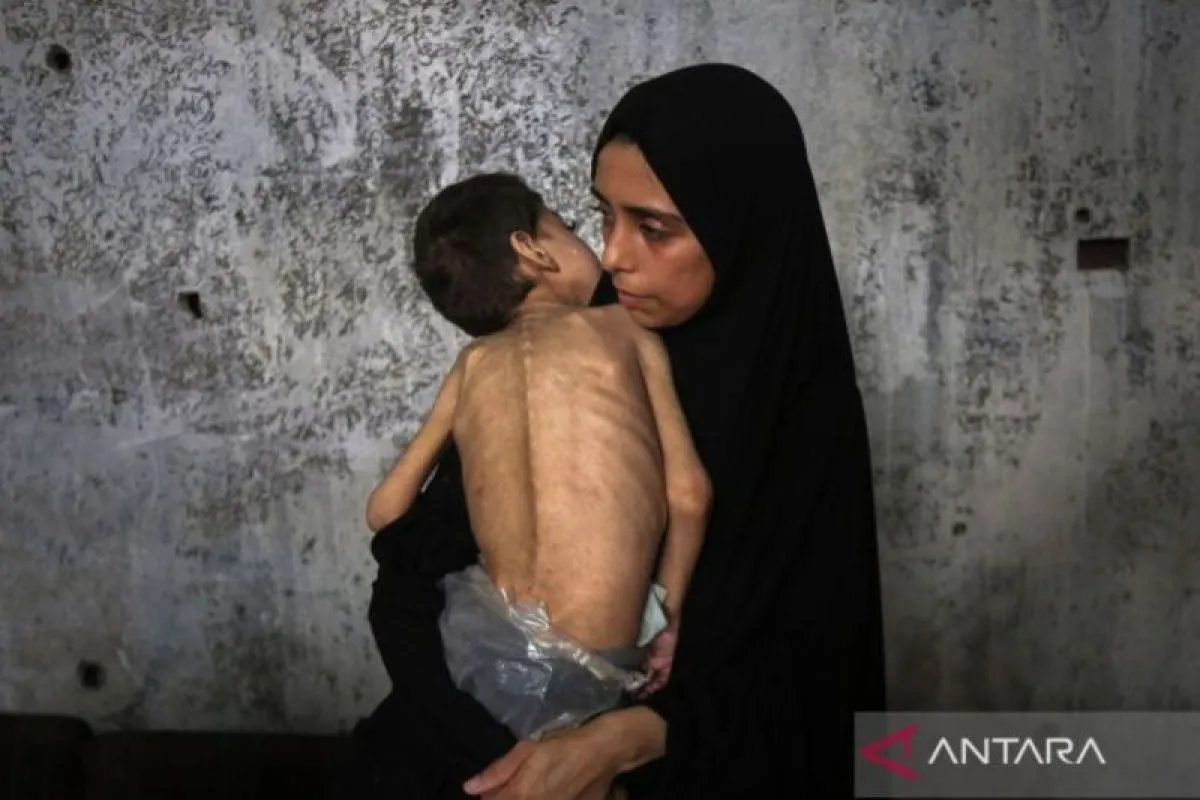 PalestinaanakmalnutrisidiGazaXinhuaRizekAbdeljawad_bar